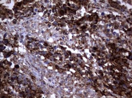 PIK3CD / PI3K Delta Antibody (aa286-610, clone OTI2D9)