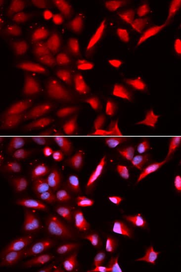 PSMC3 Antibody