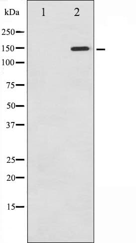 Polyclonal Rabbit anti-Human PLCG1 Antibody (phospho-Tyr771, IHC, IF, WB)