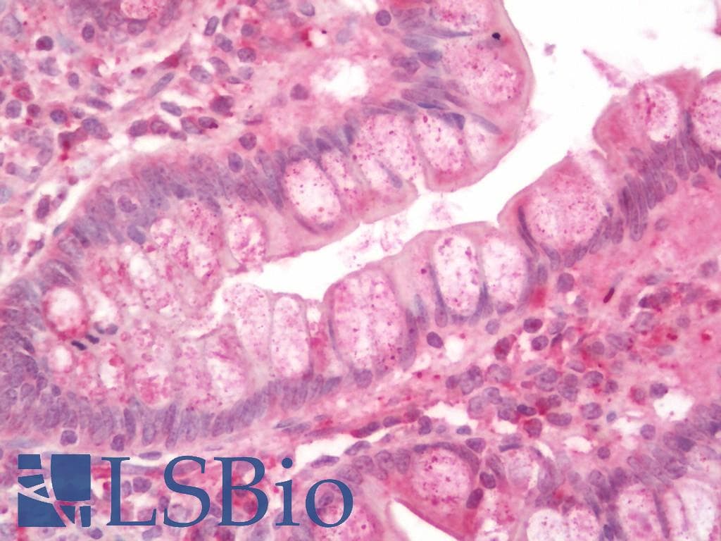 MT1G Antibody (FITC)