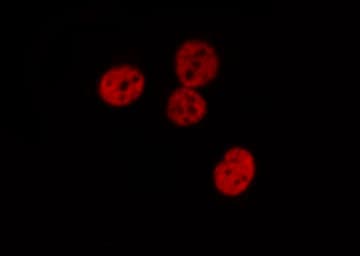 Polyclonal Rabbit anti-Human STAT1 Antibody (phospho-Tyr701, IHC, IF, WB)