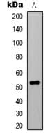 Beta Tubulin Antibody
