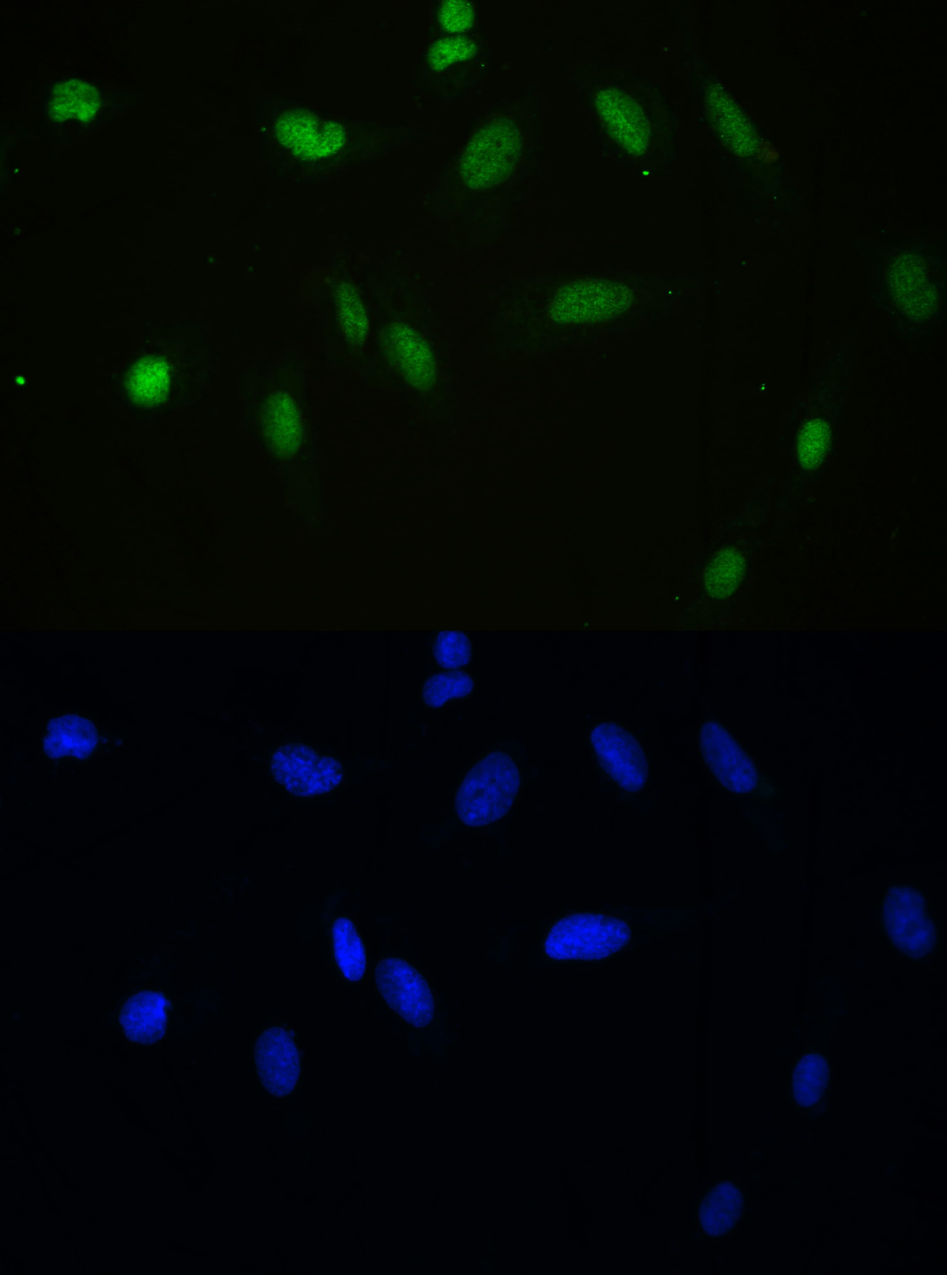 APEX1 / APE1 Antibody (aa2-318)