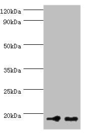 Polyclonal Rabbit anti-Human NCBP2 / CBP20 Antibody (aa1-156, IHC, WB)