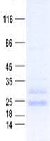Human Myozenin / MYOZ1 Protein (Recombinant His, N-Terminal)