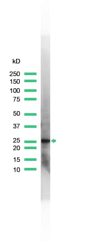 UCHL1 / PGP9.5 Antibody