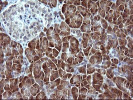SERPINB3 Antibody (clone OTI1A5)