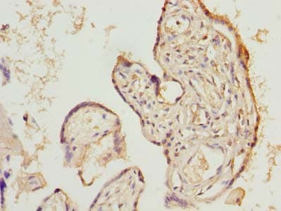 LIX1 Antibody