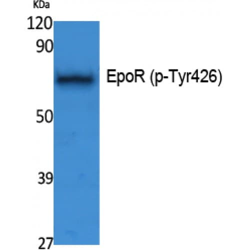 EPOR / EPO Receptor Antibody (370-450 aa)
