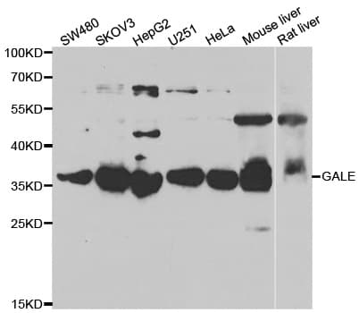 Polyclonal Rabbit anti-Human GALE / UDP-Glucose 4-Epimerase Antibody (IHC, IF, WB)