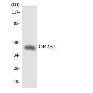 Polyclonal Rabbit anti-Human OR2B2 Antibody (aa227-276, WB)