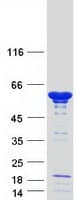 Human NAP1L1 Protein (Recombinant Myc-DDK (Flag))
