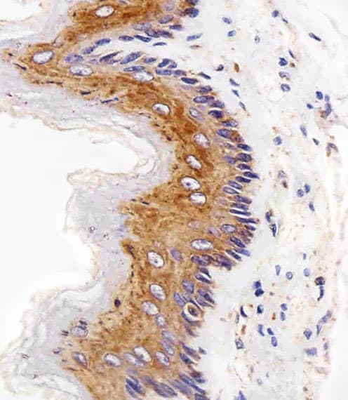 Monoclonal Mouse anti-Human EGFR Antibody (aa1163-1191, IHC, WB)