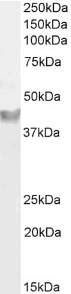 IHC-plus™ PNPLA3 / Adiponutrin Antibody (aa186-197)