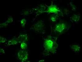 BRAF / B-Raf Antibody (clone OTI3E8)