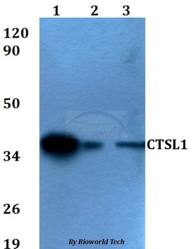 Polyclonal Rabbit anti-Human CTSL / Cathepsin L Antibody (WB)