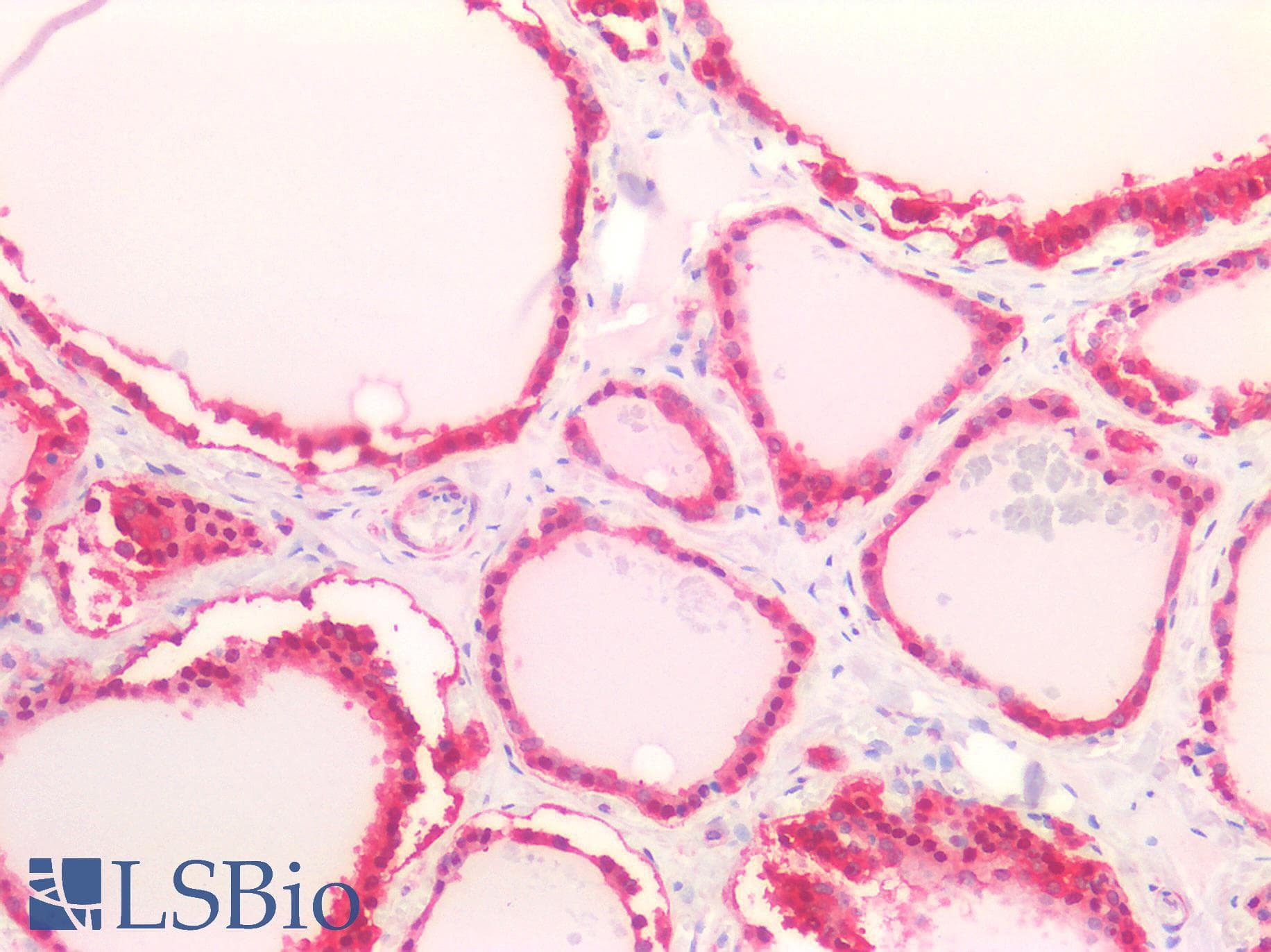 IHC-plus™ LDHB / Lactate Dehydrogenase B Antibody (aa297-310)