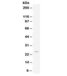 Polyclonal Rabbit anti-Human FGF19 Antibody (WB)