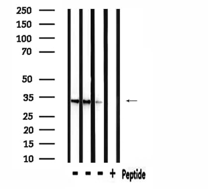 RAB40B Antibody