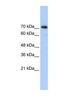 Polyclonal Rabbit anti-Human SREBF2 / SREBP2 Antibody (aa304-353, IHC, WB)