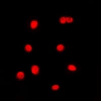 Polyclonal Rabbit anti-Human CEBPG / CEBP Gamma Antibody (Internal, IHC, IF, WB)