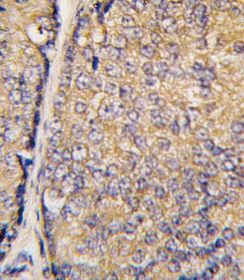 Polyclonal Rabbit anti-Human STAP1 / BRDG1 Antibody (aa41-70, IHC, WB)