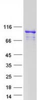Human ARMC3 Protein (Recombinant Myc-DDK (Flag))