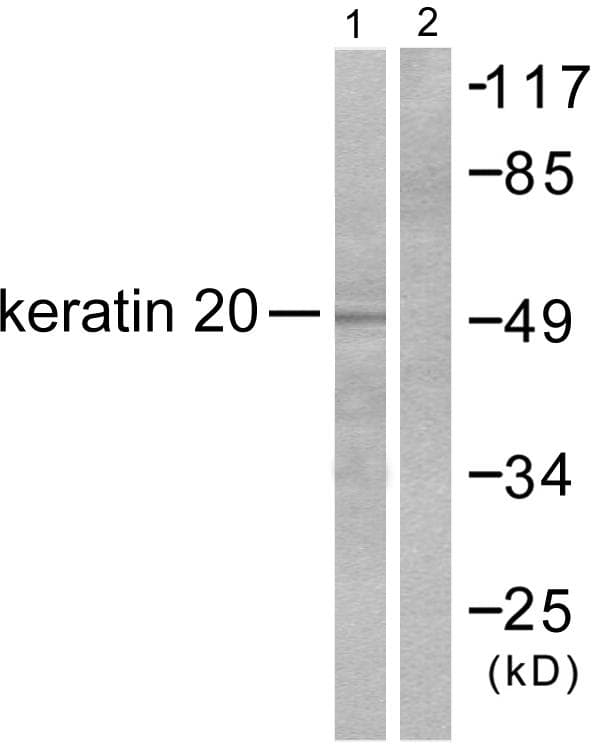 KRT20 / CK20 / Cytokeratin 20 Antibody