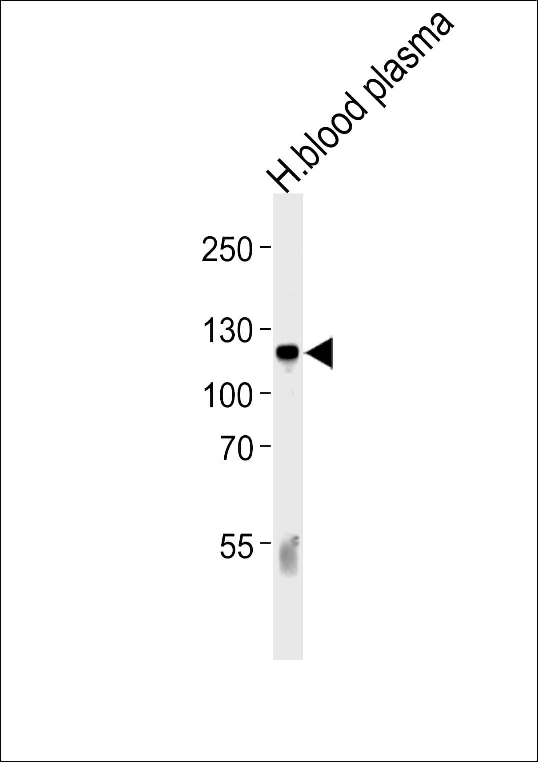 Complement C6 Antibody (aa30-58)