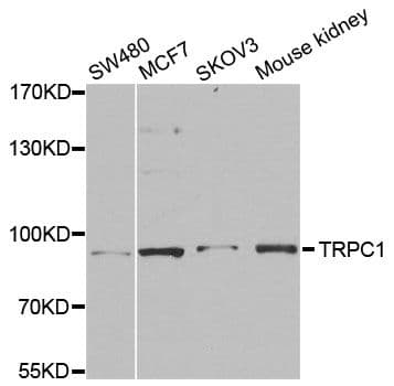 Polyclonal Rabbit anti-Human TRPC1 Antibody (WB)
