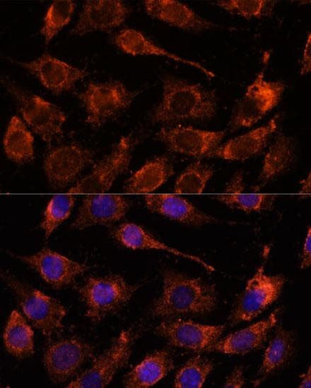 GPRASP1 / GASP-1 Antibody