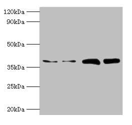 IHC-plus™ Polyclonal Rabbit anti-Human TBCC Antibody (IHC, WB)