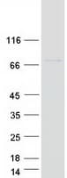 Human COG8 Protein (Recombinant Myc-DDK (Flag))
