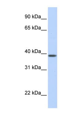SLC25A42 Antibody (N-Terminus)
