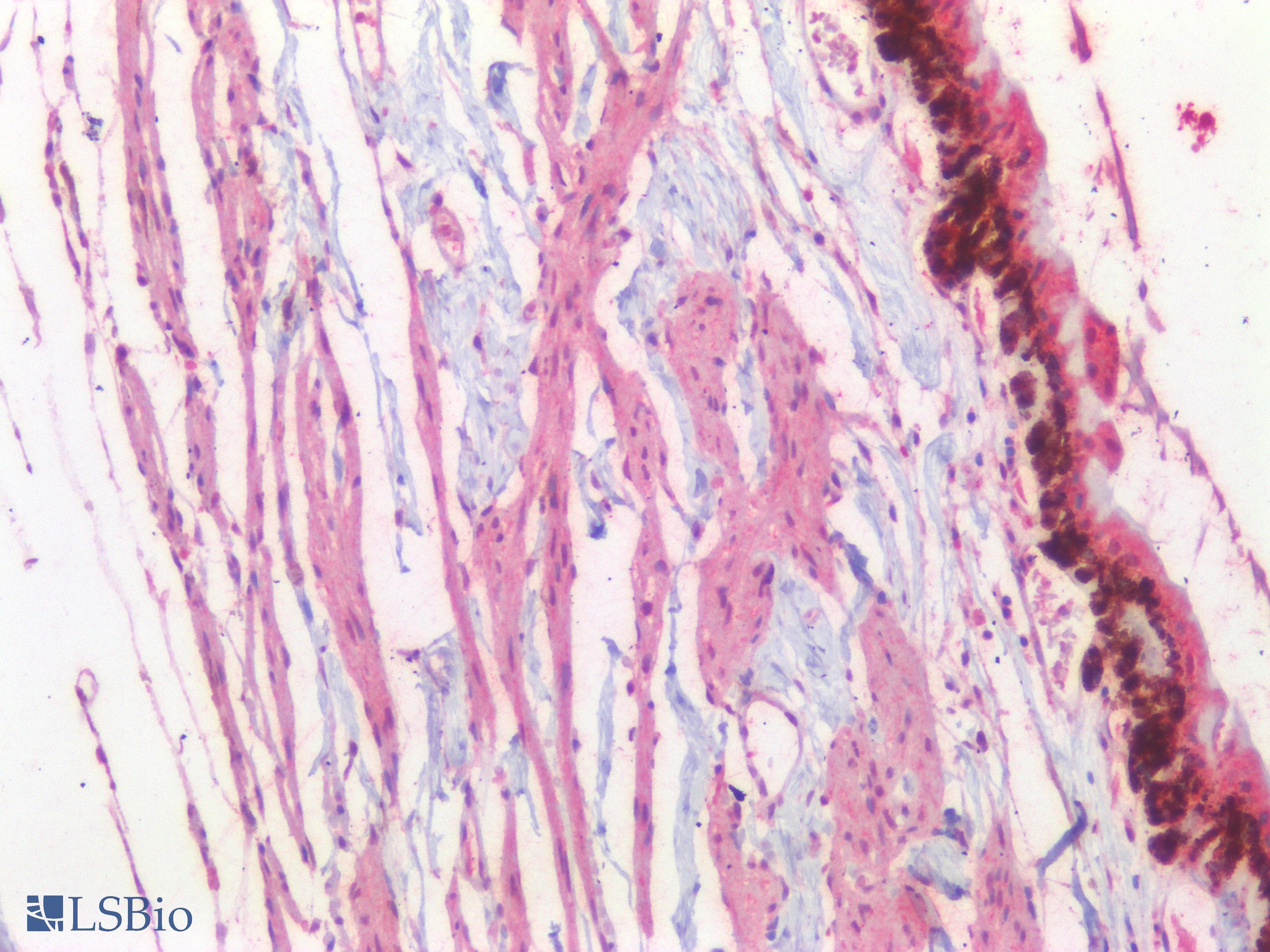 IHC-plus™ Polyclonal Rabbit anti-Human POU4F1 / BRN3A Antibody (IHC)