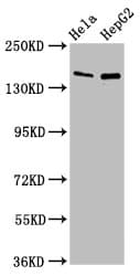 Sulfatase 1 / SULF1 Antibody