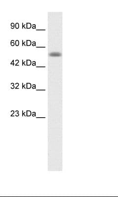 Polyclonal Rabbit anti-Human NUCB1 / Nucleobindin Antibody (C-Terminus, IHC, WB)