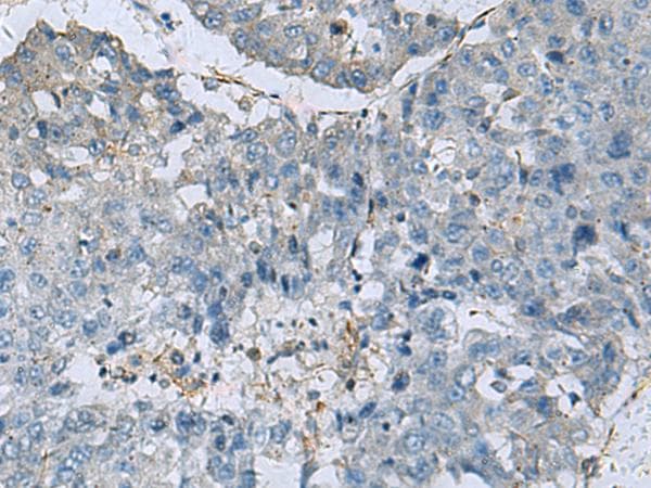 GLS / Glutaminase Antibody