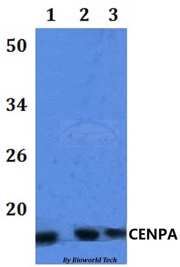 Polyclonal Rabbit anti-Human CENPA / CENP-A Antibody (WB)