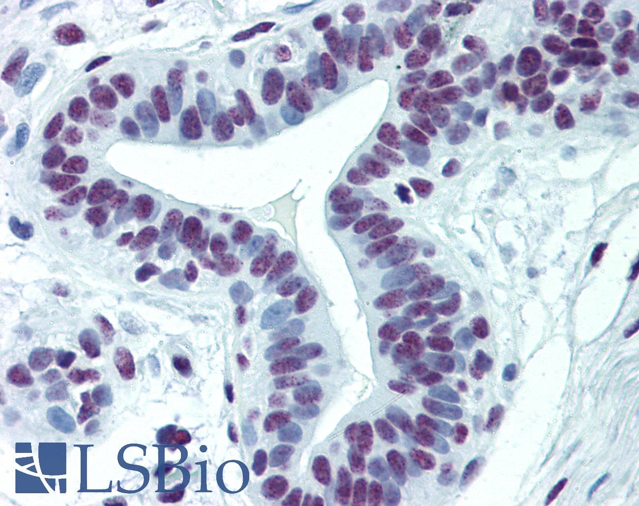 IHC-plus™ Monoclonal Mouse anti-Human CDKL1 Antibody (clone 5B11, IHC, IF, WB)