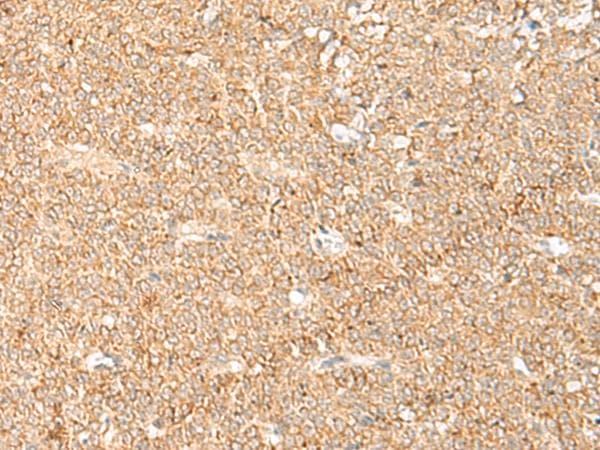 Polyclonal Rabbit anti-Human LGALSL / Galectin 5 Antibody (IHC)