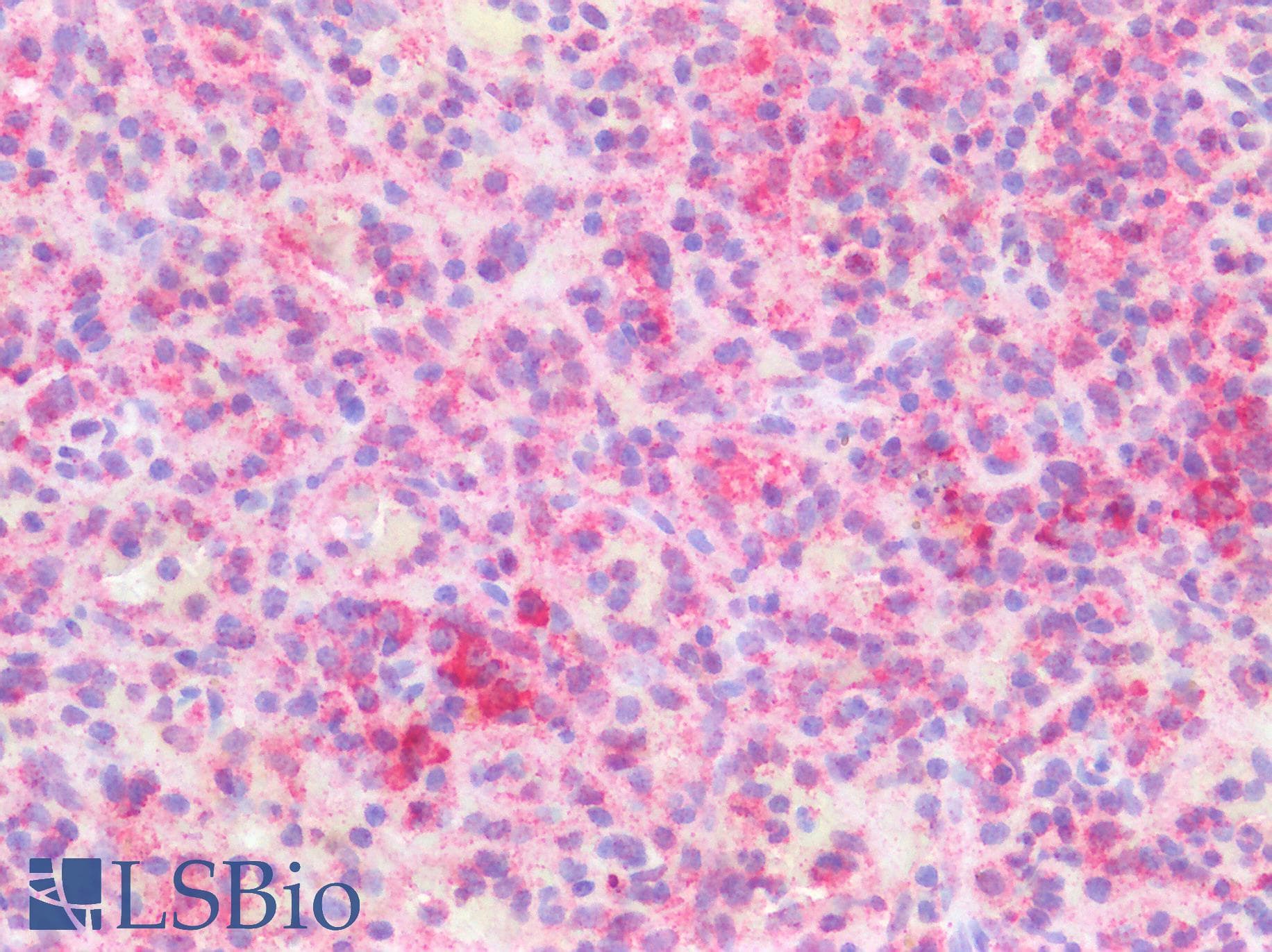 SLC40A1 / Ferroportin-1 Antibody (N-Terminus)