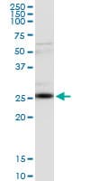 Monoclonal Mouse anti-Human CLTA / LCA Antibody (clone 4E9, WB)