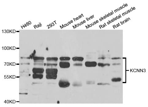 KCNN3 / SK3 Antibody