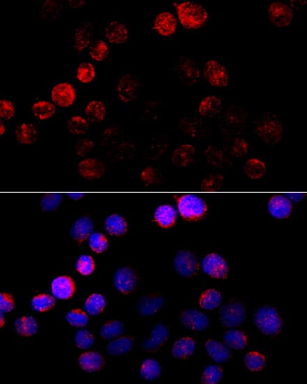CYP19 / Aromatase Antibody