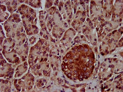 Polyclonal Rabbit anti-Human CLPTM1L / CLPTM1-Like Antibody (IHC, IF, WB)