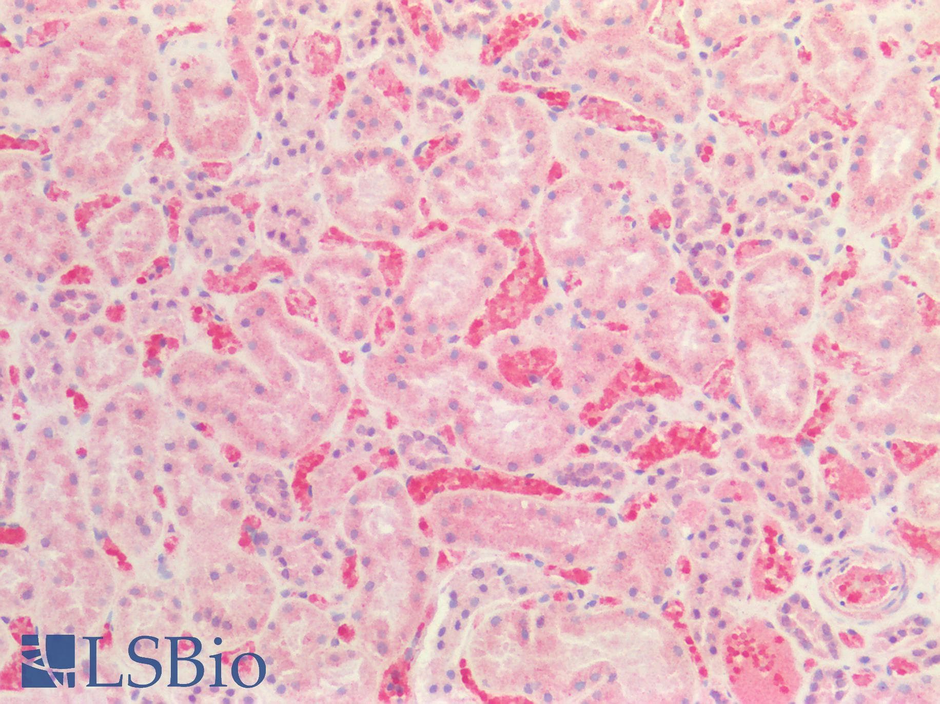 IHC-plus™ Polyclonal Rabbit anti-Human CTSS / Cathepsin S Antibody (aa32-265, IHC, WB)