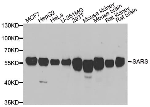 Polyclonal Rabbit anti-Human SARS / Serine-tRNA Ligase Antibody (IHC, IF, WB)