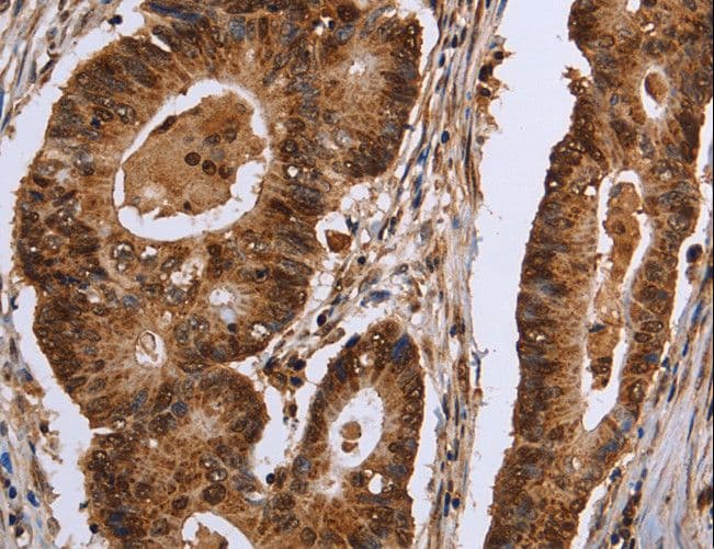 Polyclonal Rabbit anti-Human EXTL3 Antibody (IHC)