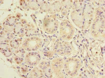 Polyclonal Rabbit anti-Human CCDC108 Antibody (Coiled-coil domain, IHC, WB)